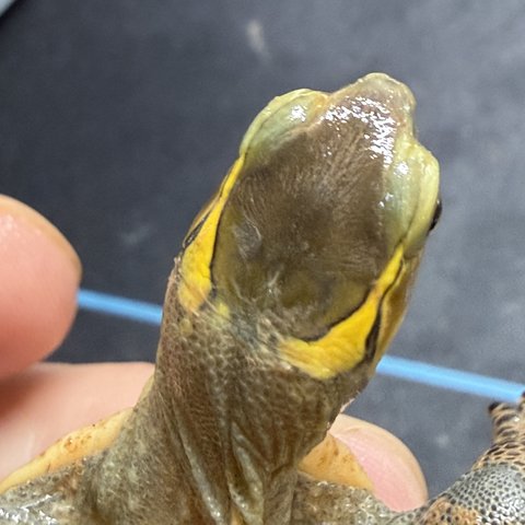 头纹